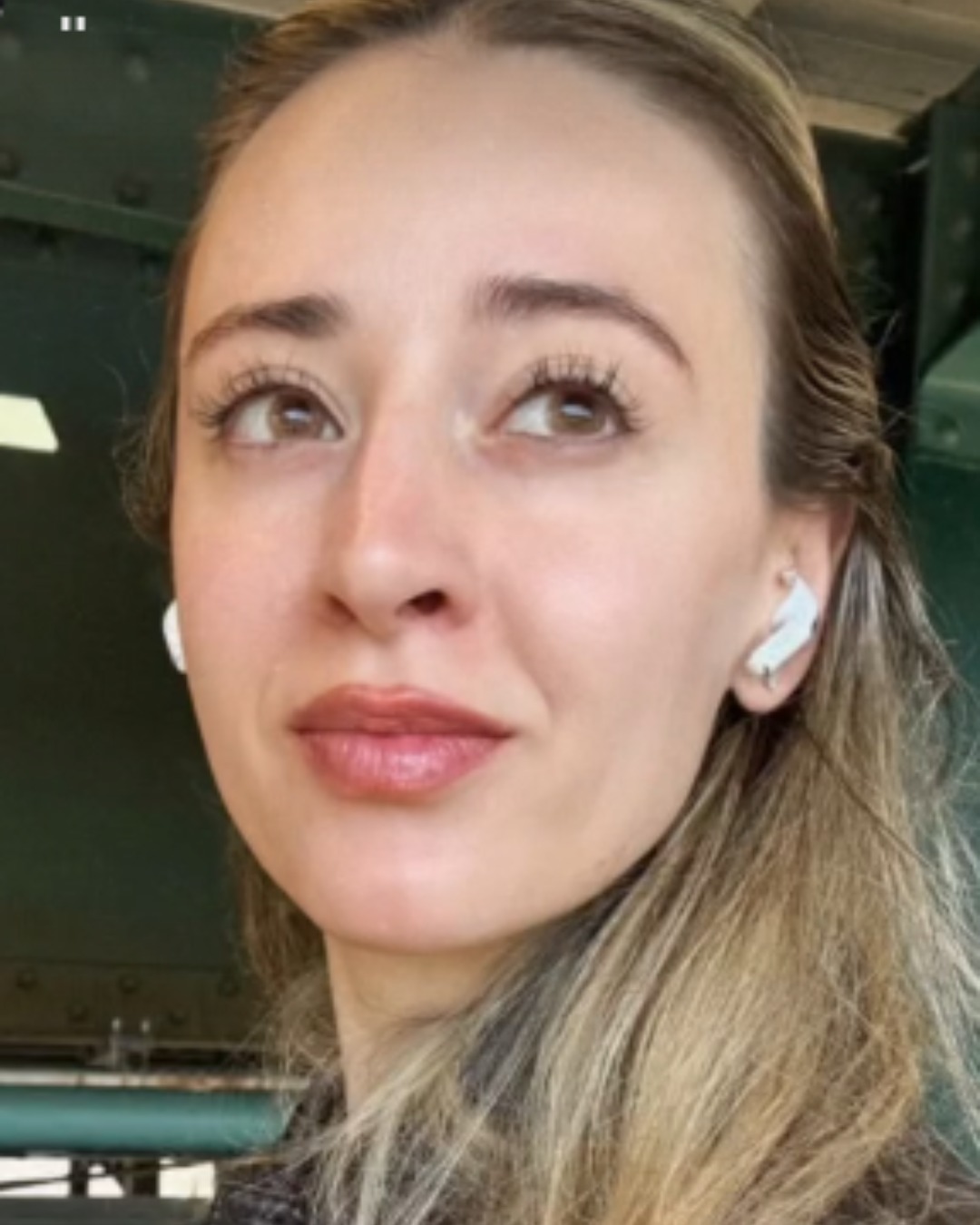 PRP with Microneedling after